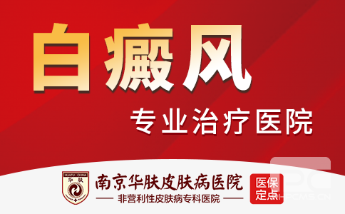 南京治白癜风的医院
