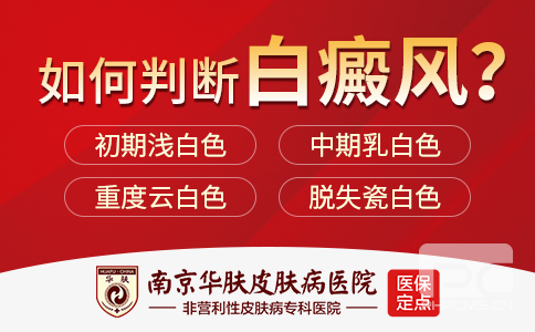 南京专业白癜风医院
